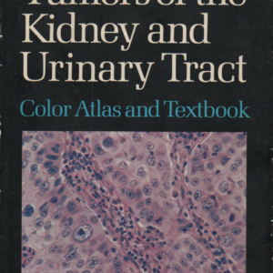 Tumors of the Kidney and Urinary Tract : Color Atlas and Textbook